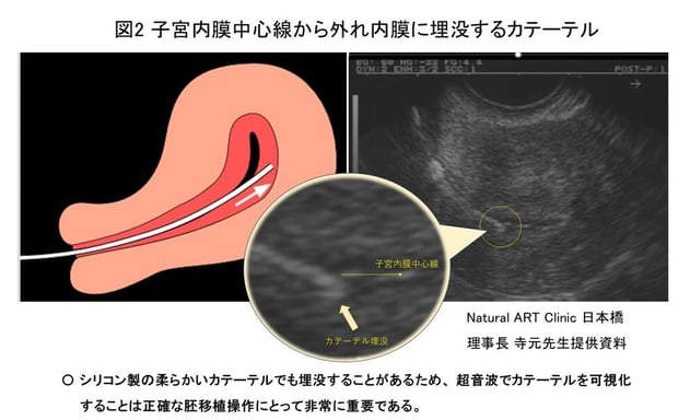 ブログ資料 (002)