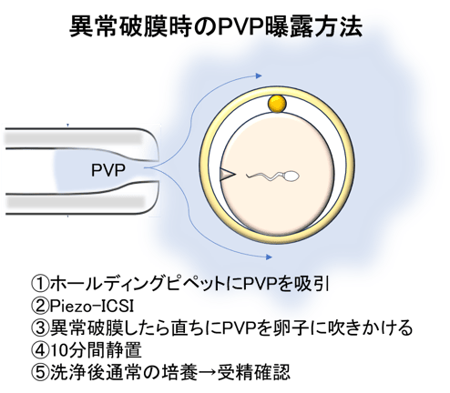 PVP_3-Mar-06-2024-04-39-24-8256-AM